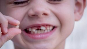 Home 12 missing tooth